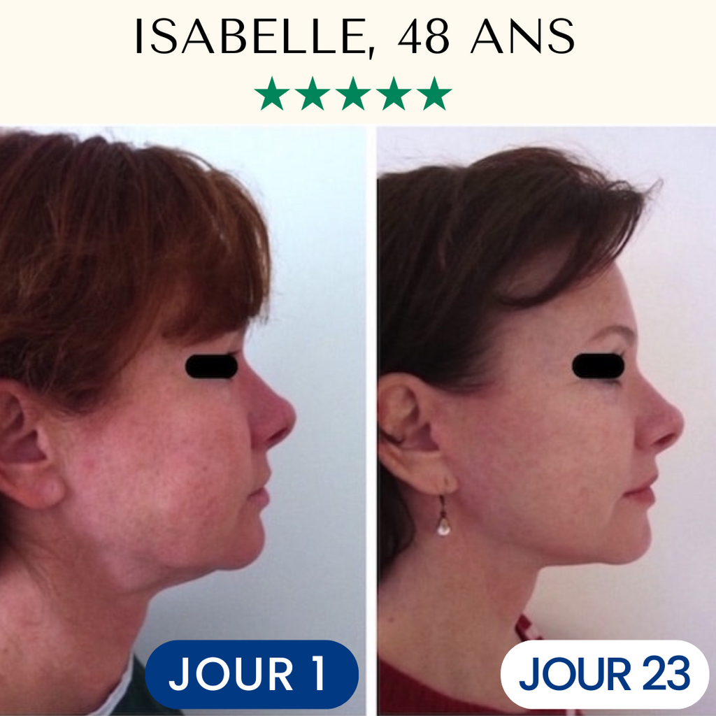 Masque Liftant Réutilisable FontanaySkin™