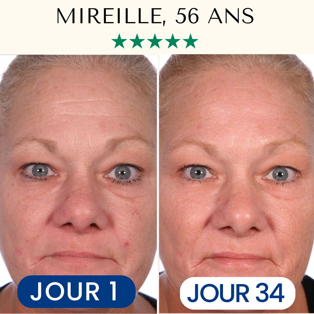 Pack Masque Collagène FontanaySkin™