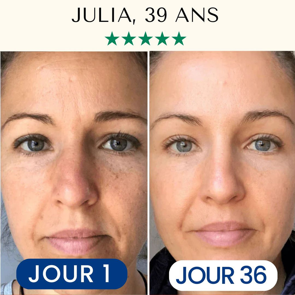 Pack Masque Collagène FontanaySkin™