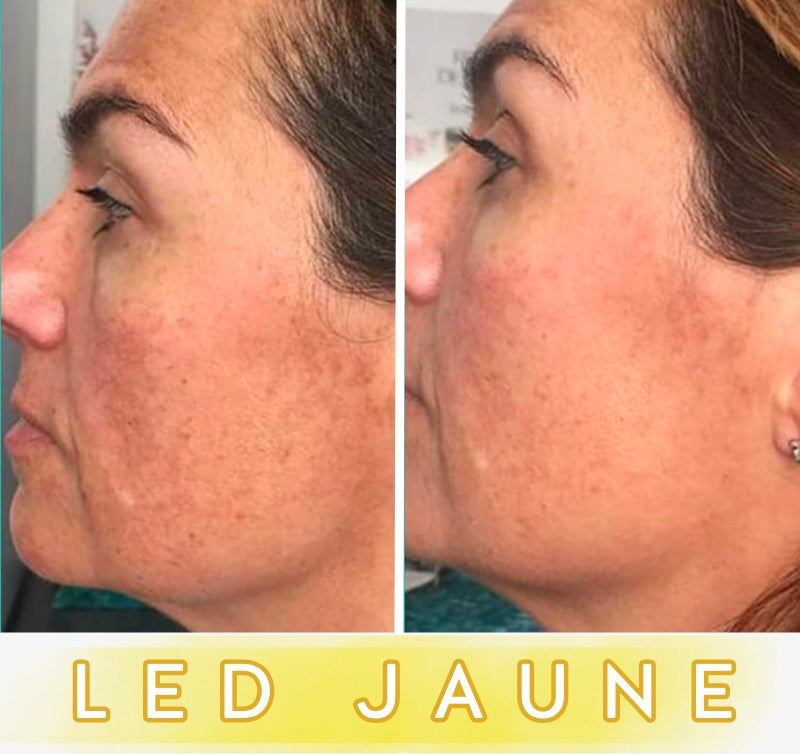 Masque LED Anti-Âge Pro - Visage
