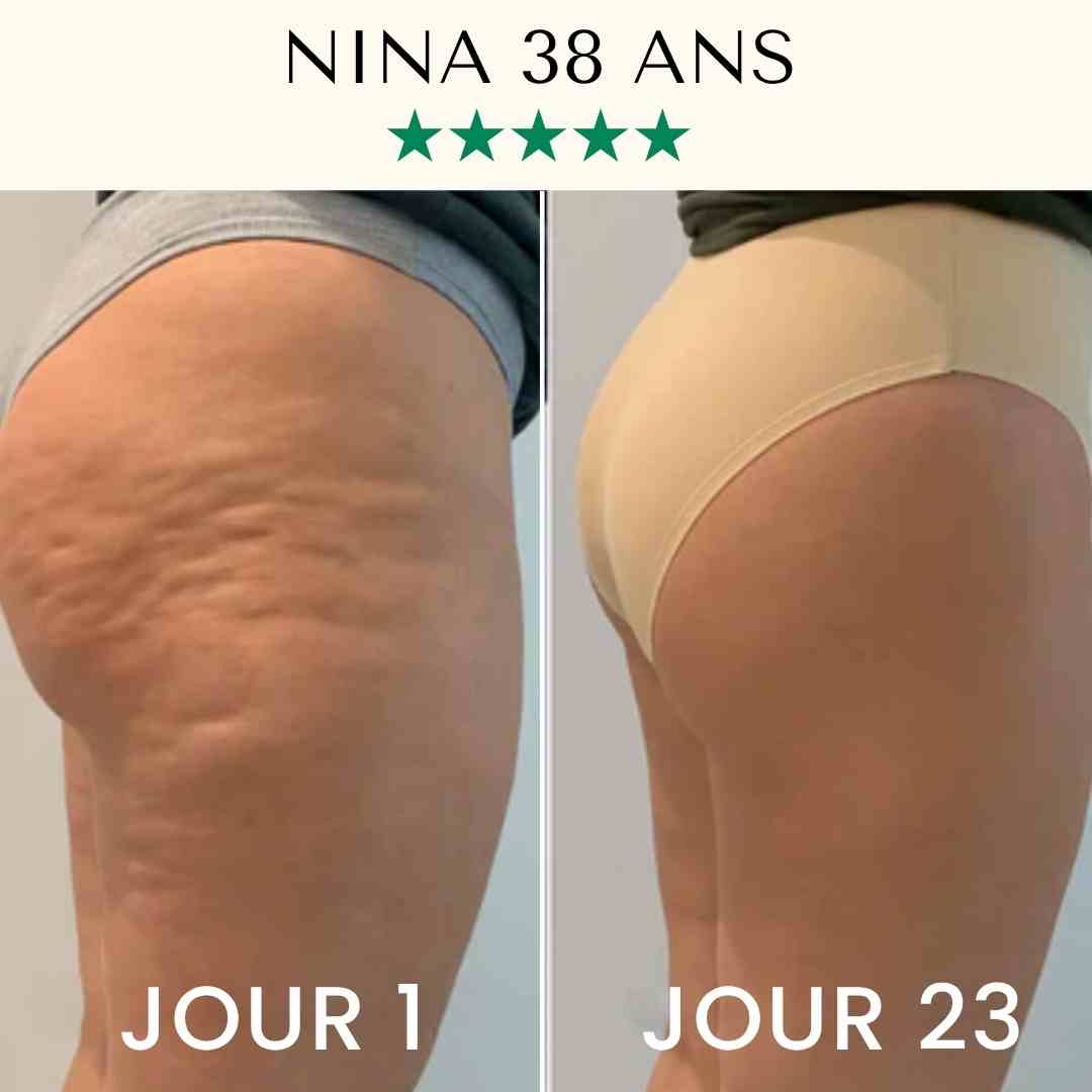 Huile Liftante Corps FontanaySkin™