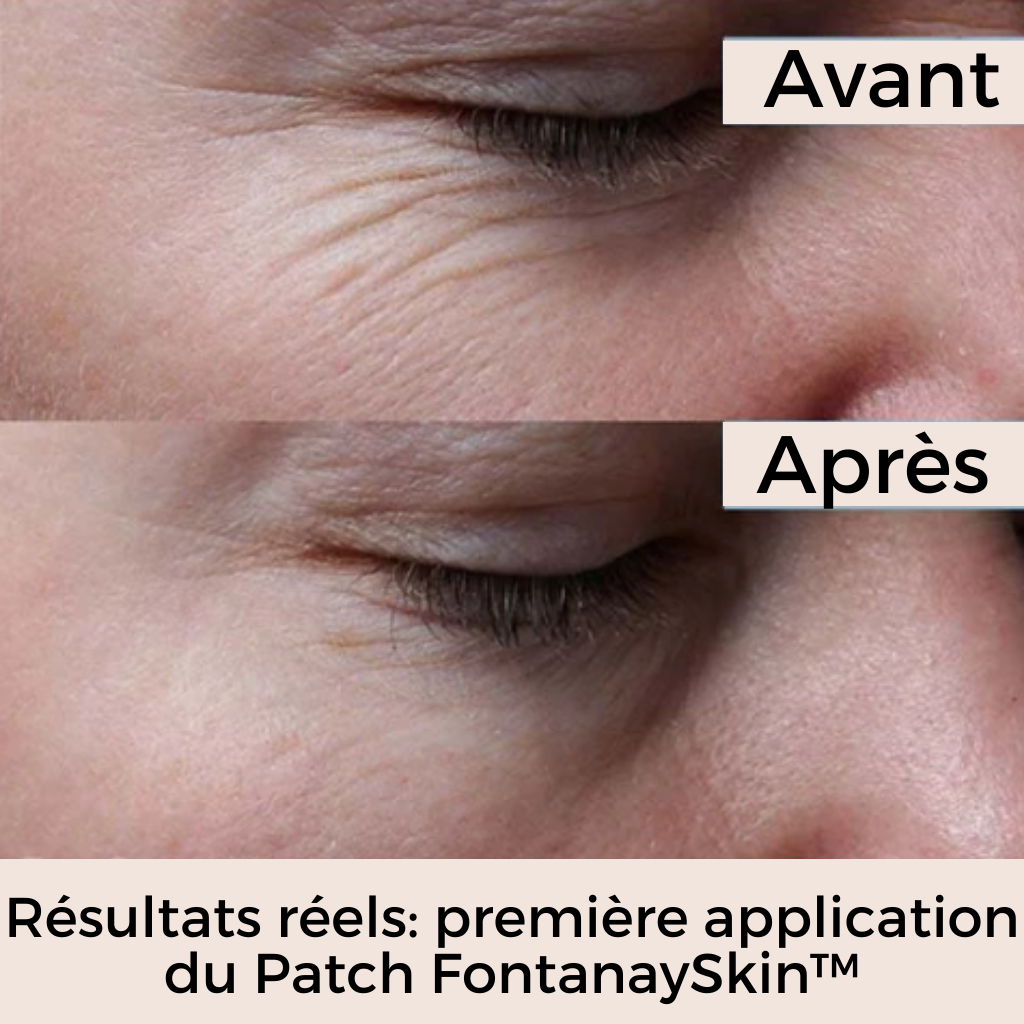 Patchs Visage Anti-Rides Réutilisables FontanaySkin™